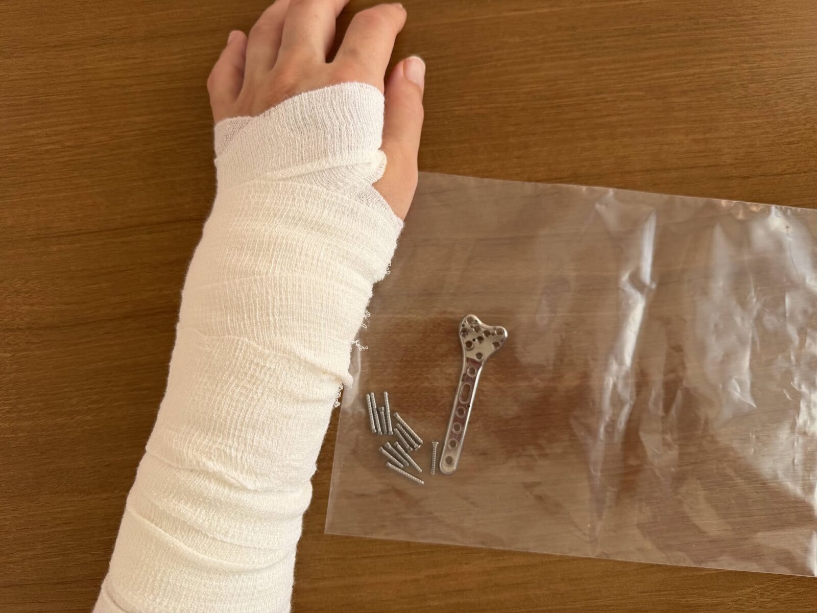 取り出したプレートとネジ